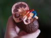 Cricket Health announces new kidney care programme for late-stage CKD and ESRD populations cricket health kidney disease care