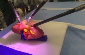 US surgeon becomes “first in nation” to rehearse procedures with Lazarus 3D kidney model