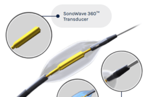 ultrasound renal denervation