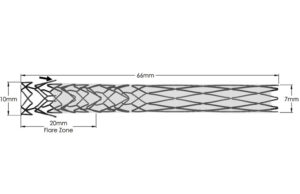Phraxis presents trial results and extended study data for EndoForce endovascular anastomotic connector