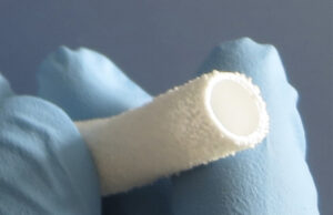 Healionics awarded US$1.25 million NIH grant to support commercialisation of novel vascular graft