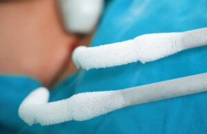 New data find cryoablation “highly effective” in treatment of solitary renal cell carcinoma