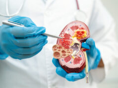 New technique detects novel biomarkers for kidney diseases with nephrotic syndrome