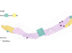 Research from the National Physical Laboratory and the University of Cambridge boosts long-term kidney transplant success rates