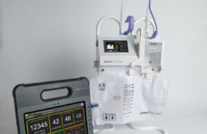 Accuryn Medical’s SmartFoley catheter reaches US milestone