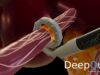 DeepQure advances clinical trials of its HyperQure extravascular renal denervation system