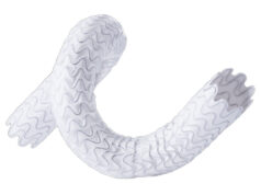 WAVE trial update reports sustained 12-month survival benefit Wrapsody device