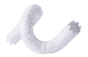 WAVE trial update reports sustained 12-month survival benefit Wrapsody device