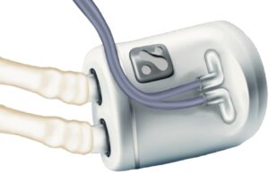 US FDA grants breakthrough designation for implantable dialysis system