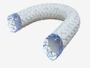Clinical trial of covered stent graft for dialysis access dysfunction completes enrolment