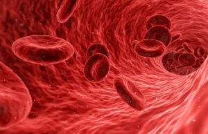 First patient treated in US trial of renal pelvic denervation technology