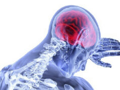 First patient treated in trial of intervention to prevent acute ischaemic brain injury during haemodialysis