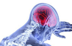 First patient treated in trial of intervention to prevent acute ischaemic brain injury during haemodialysis