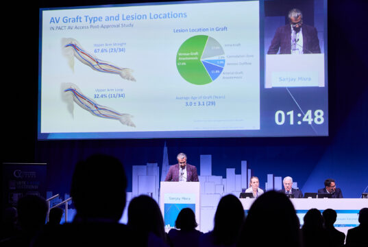 IN.PACT AV access post-approval study: Outcomes from extended cohort “consistent with prior experience”